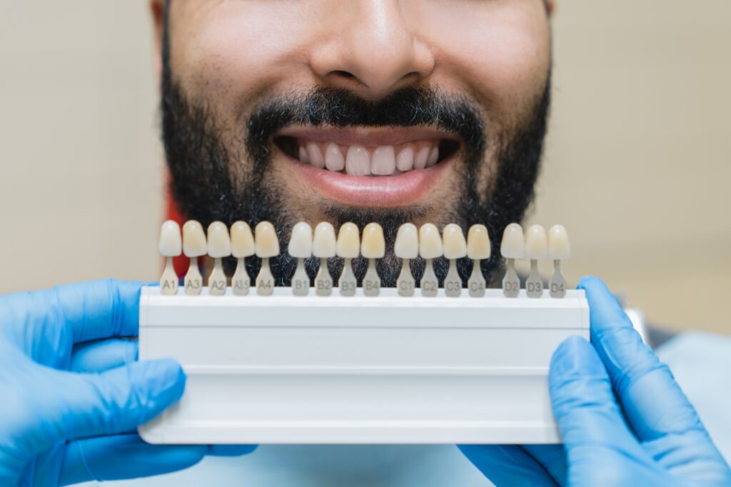 Tooth teeth tone palette. Stomatologist choosing color of patient`s teeth for whitening at clinic.